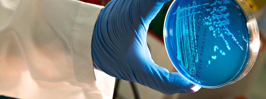The hand of a laboratory worker wearing a blue protective glove is holding a petri dish with blue agar gel showing bacterial colonies in various growth patterns